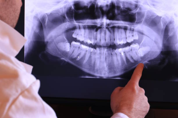Best Emergency Gum Treatment in Clifton, IL