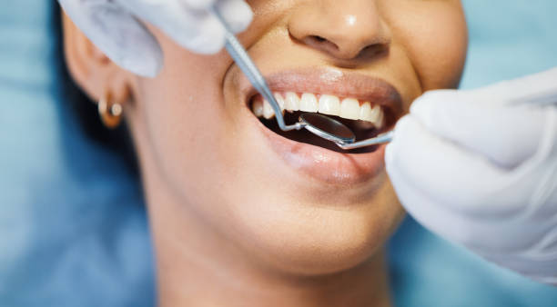 Best Emergency Wisdom Teeth Removal in Clifton, IL